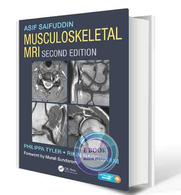 دانلود کتاب Musculoskeletal MRI 2nd  ( PDF)